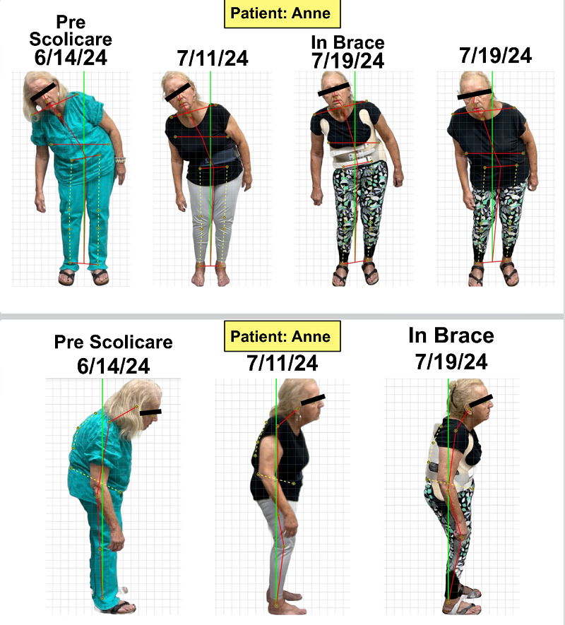 Scolicare results